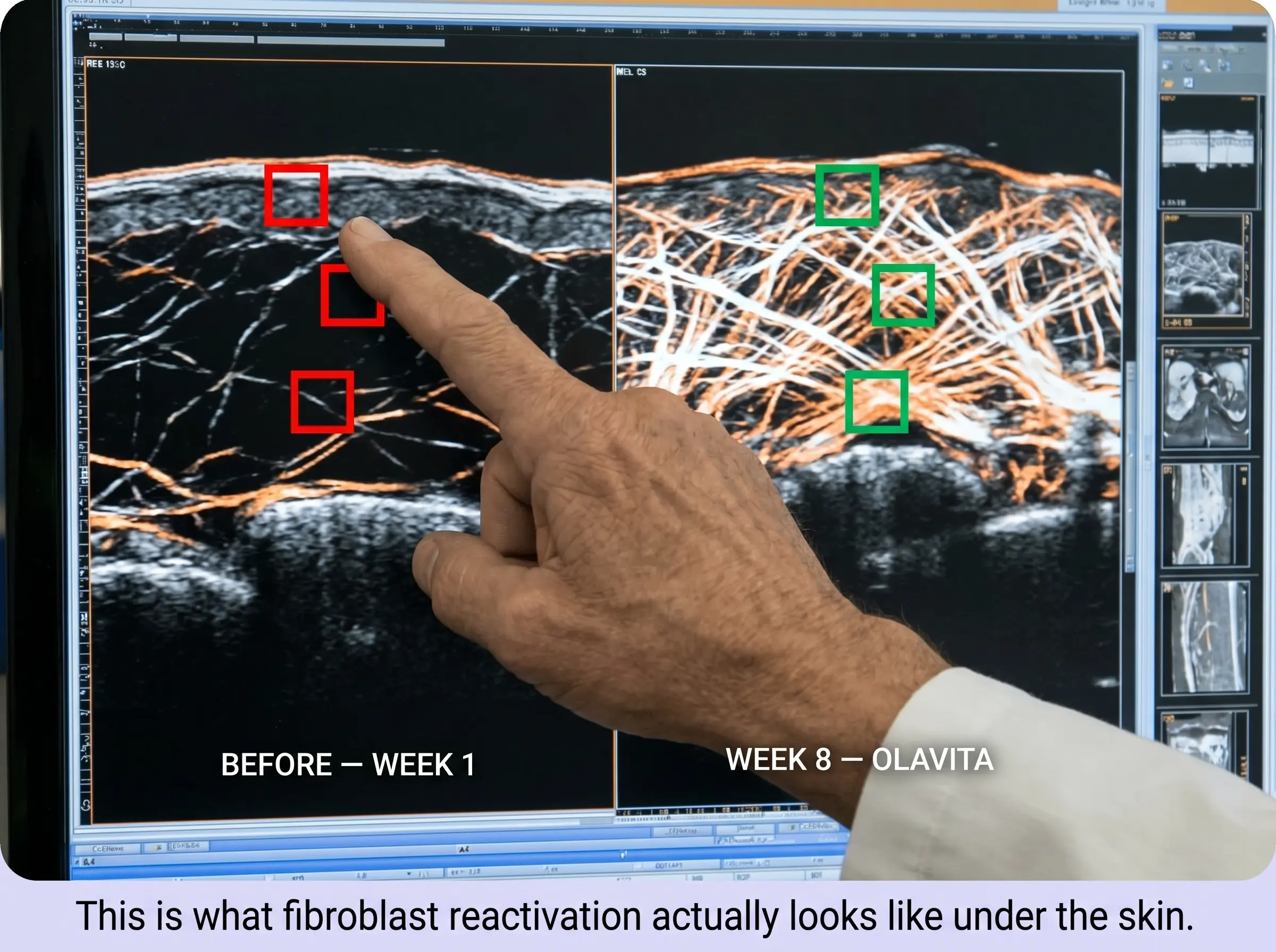Fibroblast science